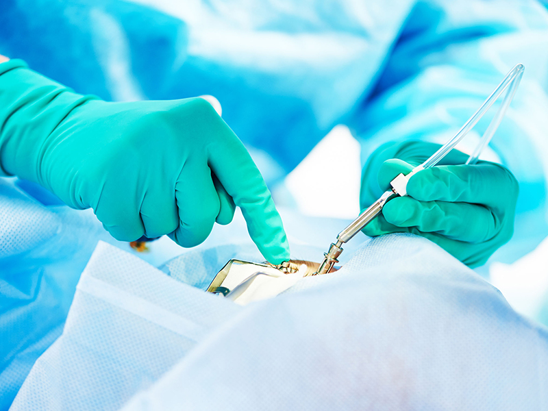 超声手术设备注册检测